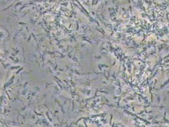 Visualisation du biofilm